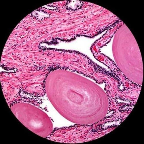 AmScope M150C / M150C-I 40X-1000X All-Metal Optical Glass Lenses Cordless LED Student Biological Compound Microscope