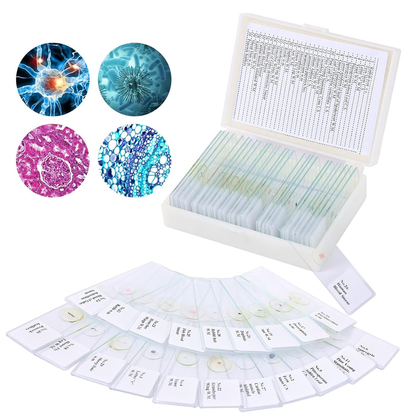 120 Microscope Slides with Specimens, Plant, Insect, Animal, Algae Slide Set for Biological Science Laboratory Basic Biological Science Education